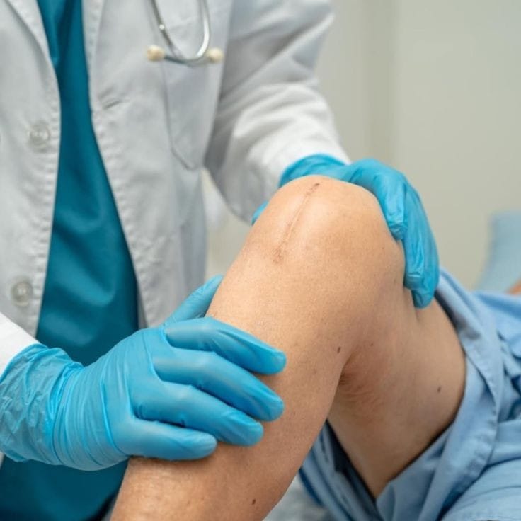 Right Knee Replacement: Types, Procedure and Recovery  