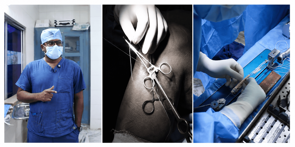 ACL surgery showing Dr. M. Mithran harvesting and preparing a hamstring graft during arthroscopic ACL reconstruction