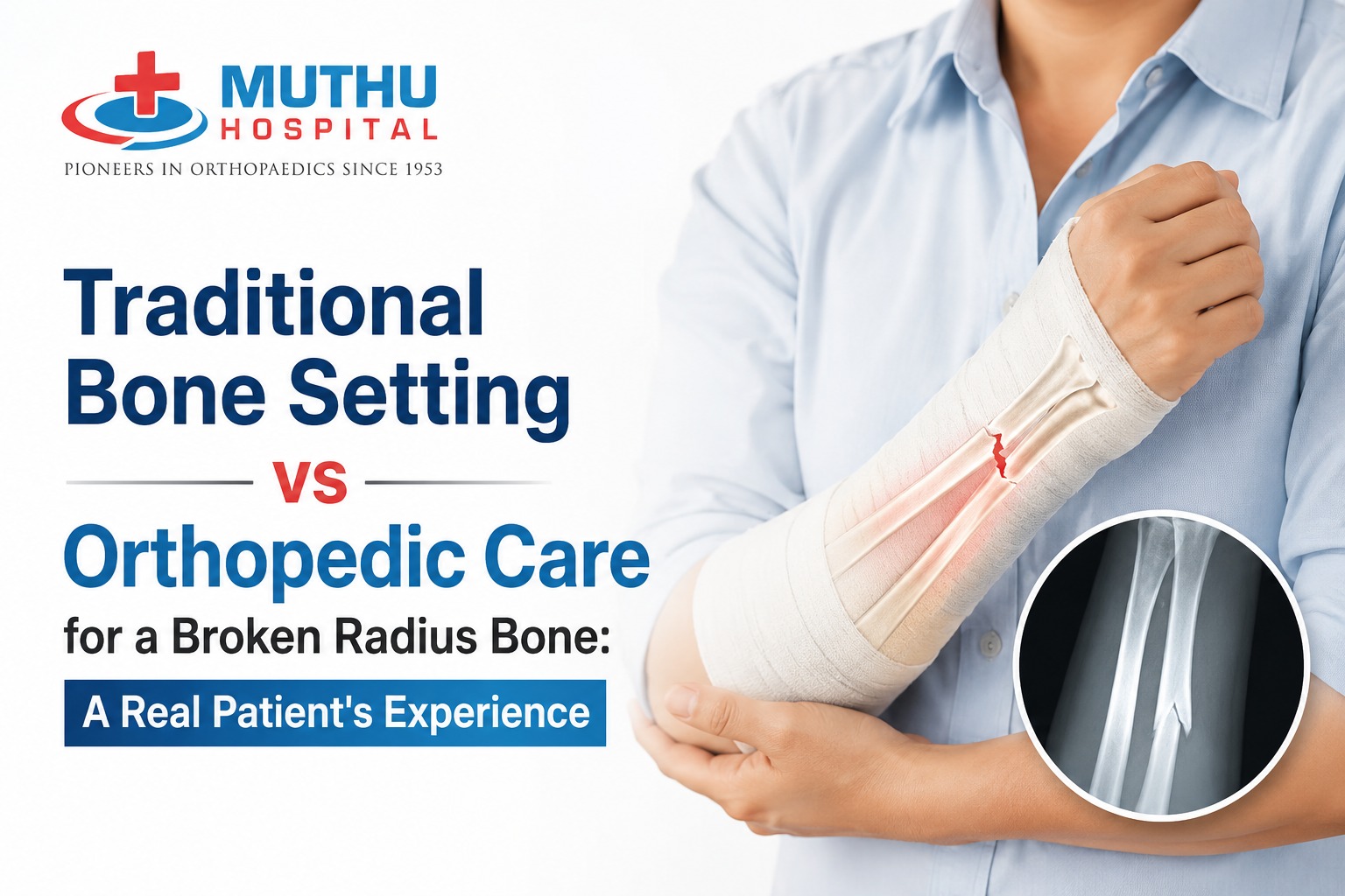 Traditional Bone Setting vs Orthopedic Care for a Broken Radius Bone: A Real Patient’s Experience  
