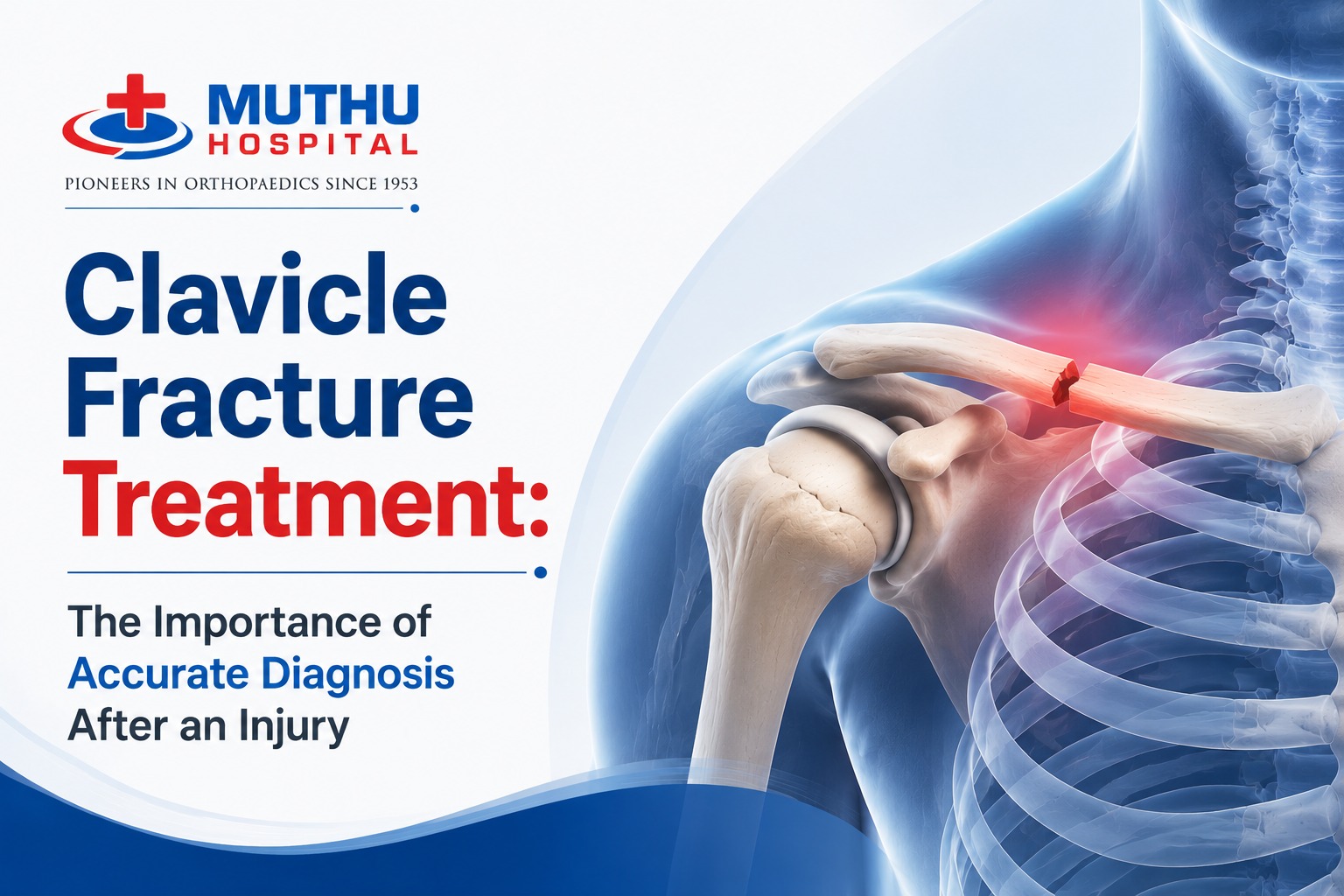 Clavicle Fracture Treatment: The Importance of Accurate Diagnosis After an Injury