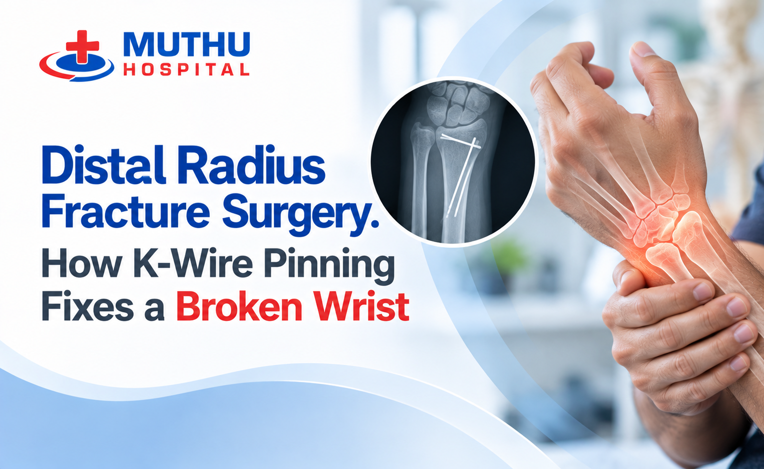 Distal Radius Fracture Surgery: How K-Wire Pinning Fixes a Broken Wrist